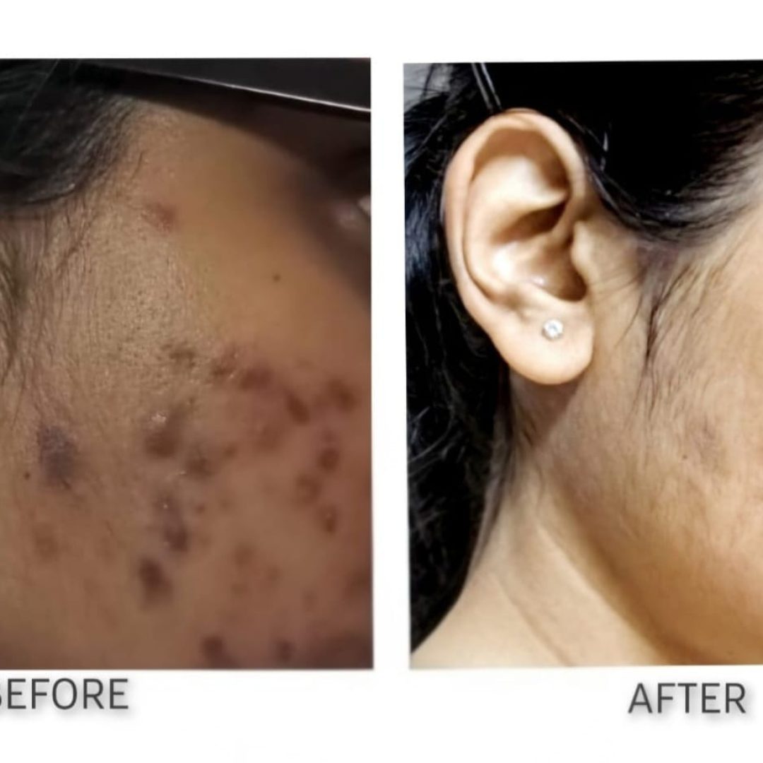 miracle skin sa testimony 1