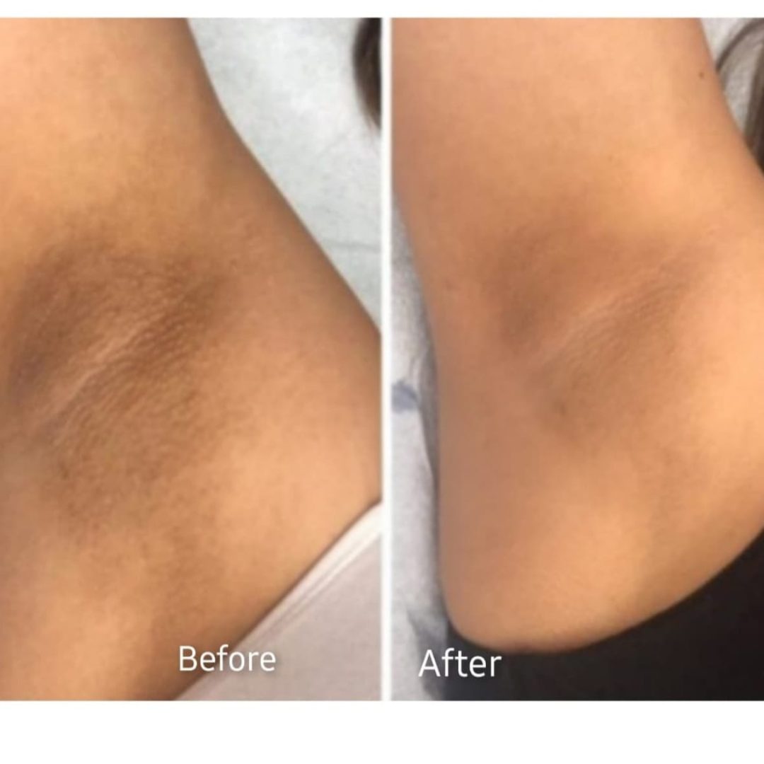 miracle skin sa testimony 2