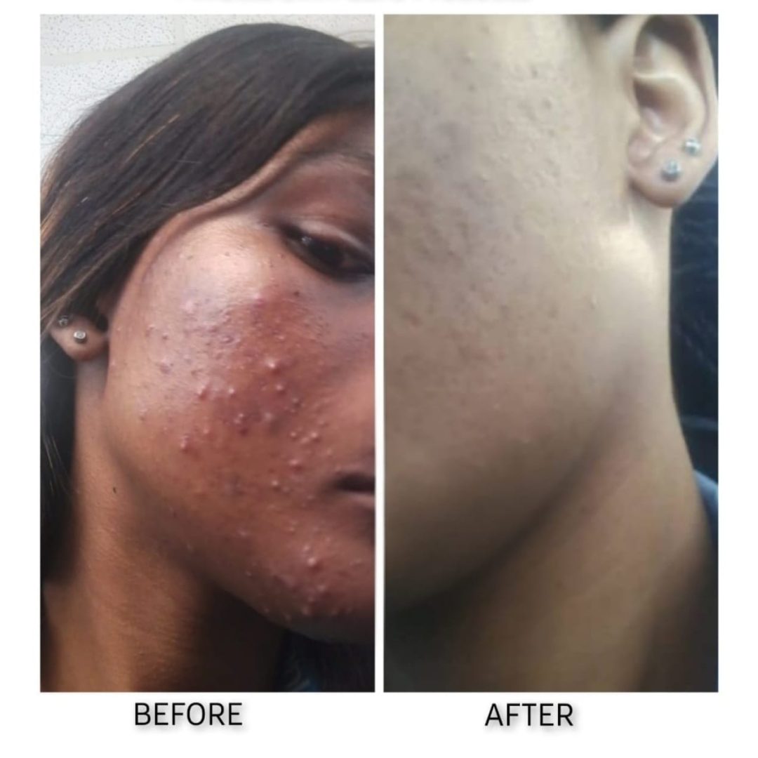 miracle skin sa testimony 3