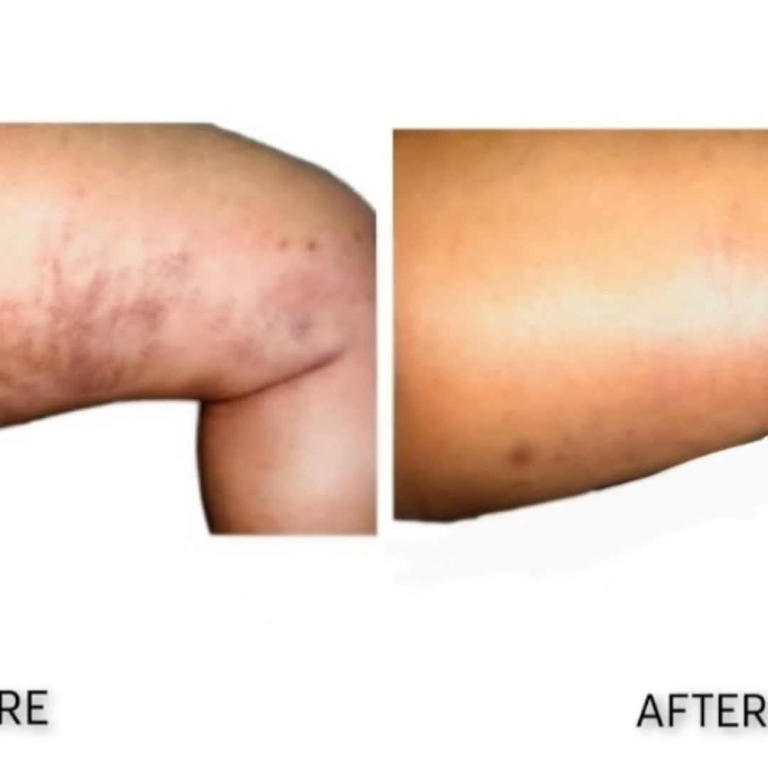 miracle skin sa testimony 5