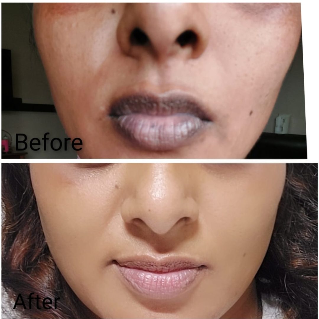 miracle skin sa testimony 7