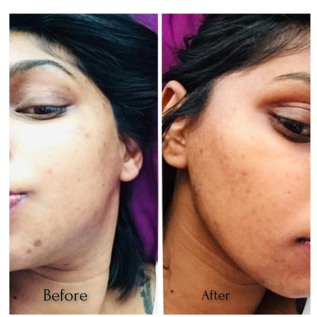 miracle skin sa testimony 8